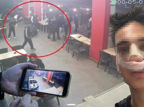 Akran zorbalığı kamerada! Hiç tanımadıkları gencin yanına gelip burnunu kırdılar
