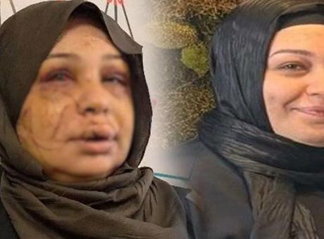 Eşinin yüzünü 60 dikiş atıldı! Kendini böyle savundu: Ben büyük bir aile katliamını önledim