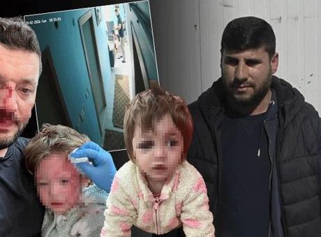 14 aylık çocuğu İkra’nın ise kafatası çatladı kendini böyle savundu: Çocuk sevgisiyle büyümüş biriyim