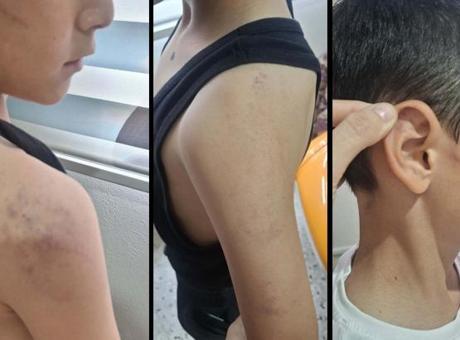 Manisa'da vicdanları sızlatan olay! Öz babadan evladına şiddet; çocuk koruma altına alındı
